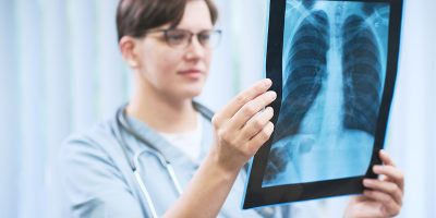 Radiologist holding chest x-ray image while examining lungs before treatment of patient in clinic