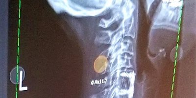 healthcare-and-medicine-imaging-osteoarthritis-2022-11-08-06-00-05-utc