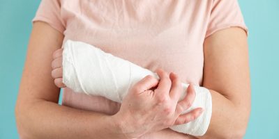 Woman with broken arm, fractured wrist. Hand in a plaster bandage, gypsum bandage.